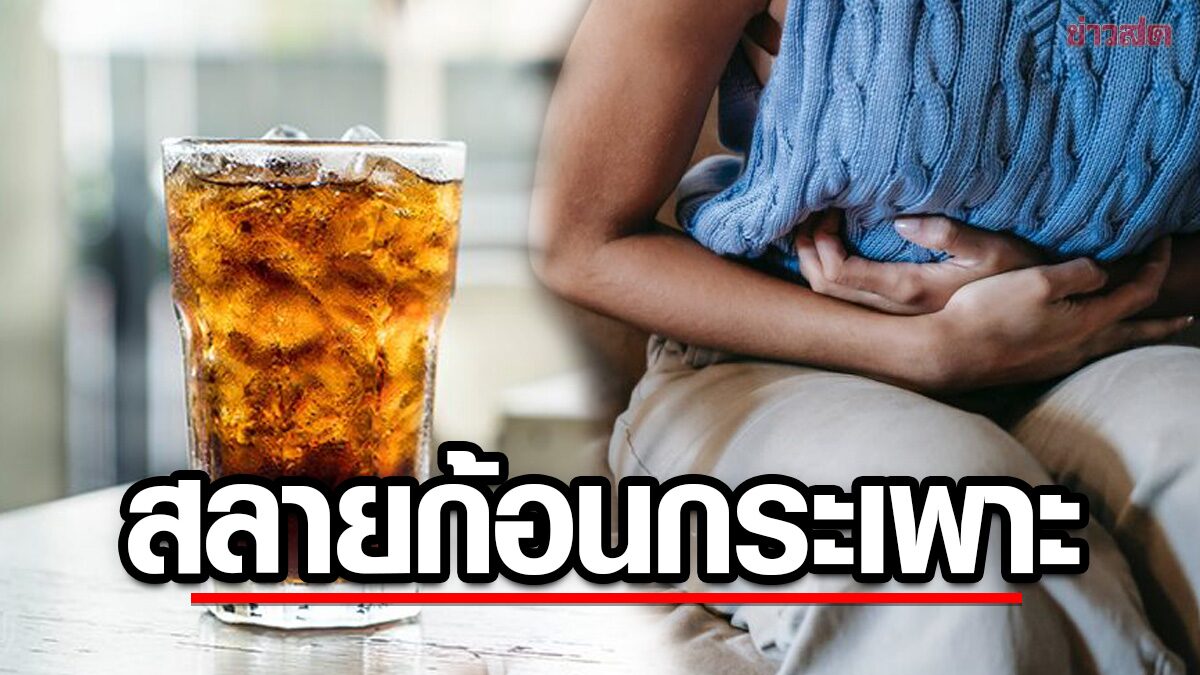 ผู้หญิง 63 ปีหลีกเลี่ยงการผ่าตัดด้วยการดื่มไดเอทโค้ก ที่ช่วยละลายก้อนอาหารในกระเพาะ